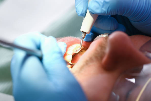 Best Orthodontic Emergency Dentist in Port Oconnor, TX